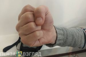 В Каменке в один день избили девушку и мужчину