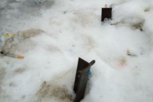 В Пензенской области мальчик упал лицом на ножки от мусорного бака. Фото