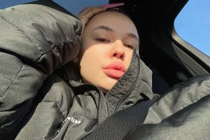 «Лысина к лицу». Инстасамка шокировала поклонников новыми снимками