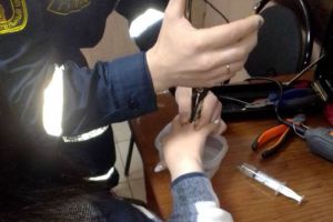 Пензячка вызвала спасателей, чтобы снять кольцо