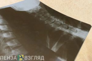 Перечень социально значимых болезней в России хотят дополнить