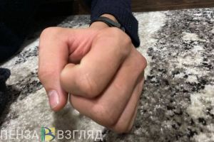 В Нижнеломовском районе мужчина сломал кости лица бывшей жене