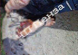Соцсети: житель Пензенской области наручниками приковал к себе оторванную руку