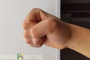 Зареченец сломал ребенку тазовую кость