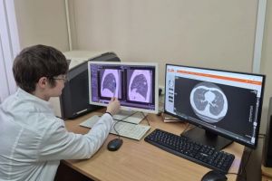 Пензенцев приглашают бесплатно пройти флюорографию