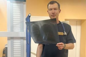 Врач предупредил пензенцев, что курение повышает риск заражения туберкулезом
