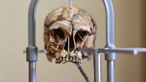 В Пензенской области нашли следы работы стоматолога II–IV веков нашей эры